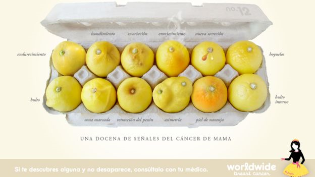 Un pezón retraído que antes no lo estaba es uno de los cambios en el pecho que las mujeres deberían consultar con un médico. (Foto, Worldwide breast cancer)