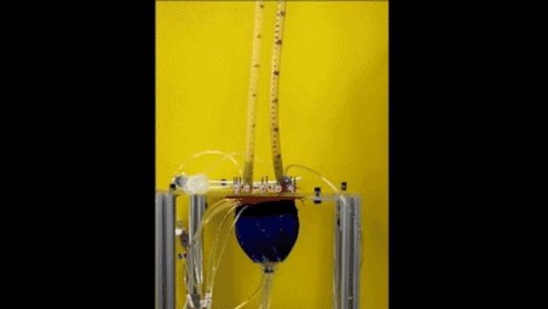 Device improves the ability of heart without having contact with the blood. (Photo: Free Press, taken from abc.is)