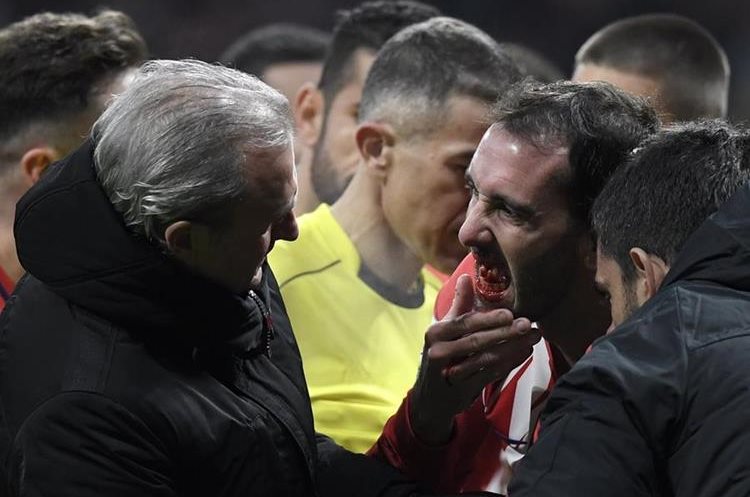 El cuadro rojiblanco aún no ha definido el tiempo que será baja el defensor uruguayo. (Foto Prensa Libre: AFP)